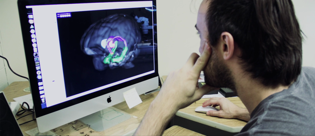 Man studies 3D image of the brain on a computer for research. 